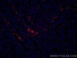 VE-cadherin Antibody in Immunohistochemistry (Paraffin) (IHC (P))