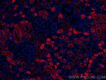 AQP1 Antibody in Immunohistochemistry (Paraffin) (IHC (P))