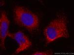 GRB2 Antibody in Immunocytochemistry (ICC/IF)