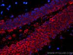 PTGER4 Antibody in Immunohistochemistry (Paraffin) (IHC (P))