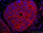 ROR1 Antibody in Immunohistochemistry (Paraffin) (IHC (P))