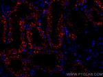 LGMN Antibody in Immunohistochemistry (Paraffin) (IHC (P))