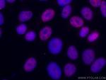 DDX5 Antibody in Immunocytochemistry (ICC/IF)