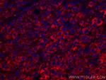 CYP27A1 Antibody in Immunohistochemistry (Paraffin) (IHC (P))