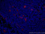 Endoglin/CD105 Antibody in Immunohistochemistry (Paraffin) (IHC (P))