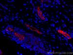 Endoglin/CD105 Antibody in Immunohistochemistry (Paraffin) (IHC (P))