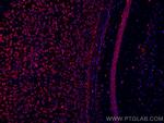 L1CAM Antibody in Immunohistochemistry (Paraffin) (IHC (P))