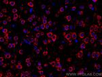 L1CAM Antibody in Immunohistochemistry (Paraffin) (IHC (P))