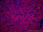 GCK Antibody in Immunohistochemistry (Paraffin) (IHC (P))