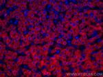 GCK Antibody in Immunohistochemistry (Paraffin) (IHC (P))