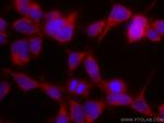 VAMP4 Antibody in Immunocytochemistry (ICC/IF)