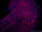 MYH10 Antibody in Immunohistochemistry (Paraffin) (IHC (P))