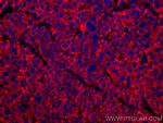 FUCA1 Antibody in Immunohistochemistry (Paraffin) (IHC (P))