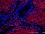 Collagen Type I Antibody in Immunohistochemistry (Paraffin) (IHC (P))