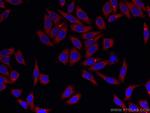 ATG7 Antibody in Immunocytochemistry (ICC/IF)