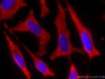 ALDH9A1 Antibody in Immunocytochemistry (ICC/IF)