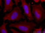 Profilin 1 Antibody in Immunocytochemistry (ICC/IF)