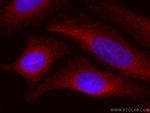 MEK2 Antibody in Immunocytochemistry (ICC/IF)