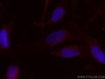 CDCA5 Antibody in Immunocytochemistry (ICC/IF)