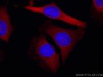 ALDOA Antibody in Immunocytochemistry (ICC/IF)