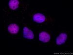 PDS5A Antibody in Immunocytochemistry (ICC/IF)