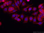 IPO4 Antibody in Immunocytochemistry (ICC/IF)