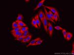 EEF2 Antibody in Immunocytochemistry (ICC/IF)