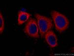 RIG-1/DDX58 Antibody in Immunocytochemistry (ICC/IF)