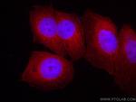 EIF1 Antibody in Immunocytochemistry (ICC/IF)