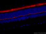 ANO2 Antibody in Immunohistochemistry (Paraffin) (IHC (P))