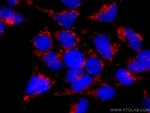 LRPPRC Antibody in Immunocytochemistry (ICC/IF)