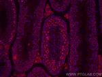 METTL3 Antibody in Immunohistochemistry (Paraffin) (IHC (P))