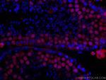 METTL3 Antibody in Immunohistochemistry (Paraffin) (IHC (P))