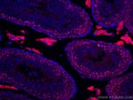 METTL3 Antibody in Immunohistochemistry (Paraffin) (IHC (P))