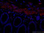 Desmin Antibody in Immunohistochemistry (Paraffin) (IHC (P))