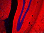 Synaptophysin Antibody in Immunohistochemistry (Paraffin) (IHC (P))