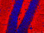 Synaptophysin Antibody in Immunohistochemistry (Paraffin) (IHC (P))