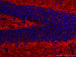 Synaptophysin Antibody in Immunohistochemistry (Paraffin) (IHC (P))