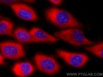 GARS Antibody in Immunocytochemistry (ICC/IF)