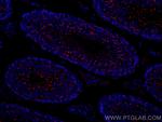 TEX14 Antibody in Immunohistochemistry (Paraffin) (IHC (P))