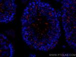 TEX14 Antibody in Immunohistochemistry (Paraffin) (IHC (P))