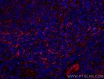 TMEM173/STING Antibody in Immunohistochemistry (Paraffin) (IHC (P))