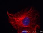 Beta Tubulin Antibody in Immunocytochemistry (ICC/IF)