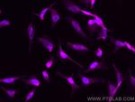 CDK9 Antibody in Immunocytochemistry (ICC/IF)