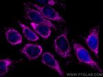 TOM20 Antibody in Immunocytochemistry (ICC/IF)