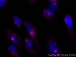 PCM1 Antibody in Immunocytochemistry (ICC/IF)