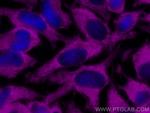 GAPDH Antibody in Immunocytochemistry (ICC/IF)