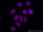 TBP Antibody in Immunocytochemistry (ICC/IF)