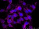 UCHL1/PGP9.5 Antibody in Immunocytochemistry (ICC/IF)