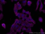 Phospho-RIPK1 (Ser161) Antibody in Immunocytochemistry (ICC/IF)